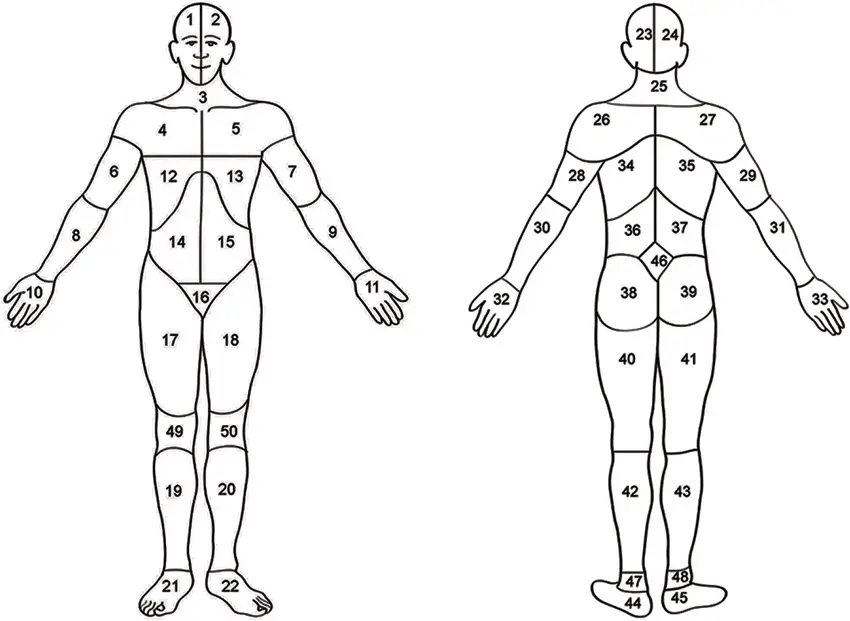 pain-diagram-goodman-heidrich